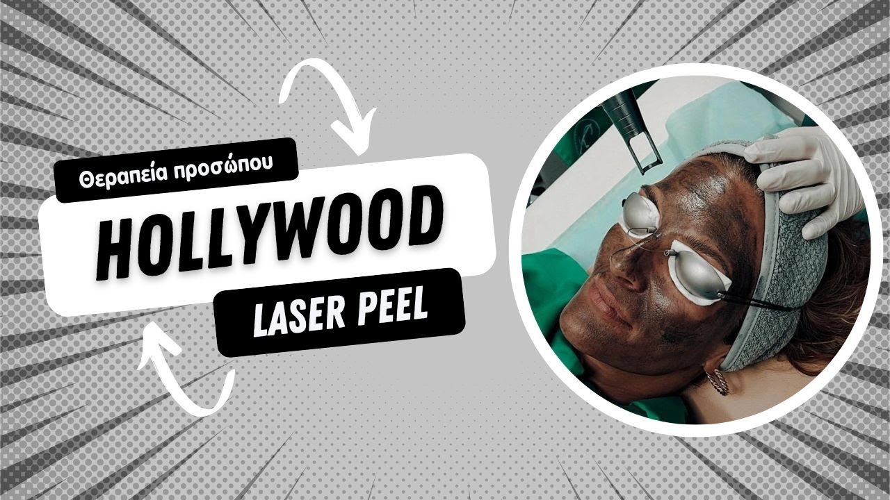 Hollywood Peel με laser Spectra Lutronic