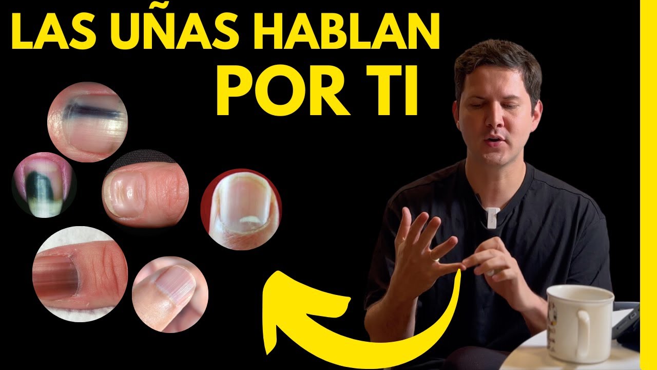 ENFERMEDADES DE LAS UÑAS