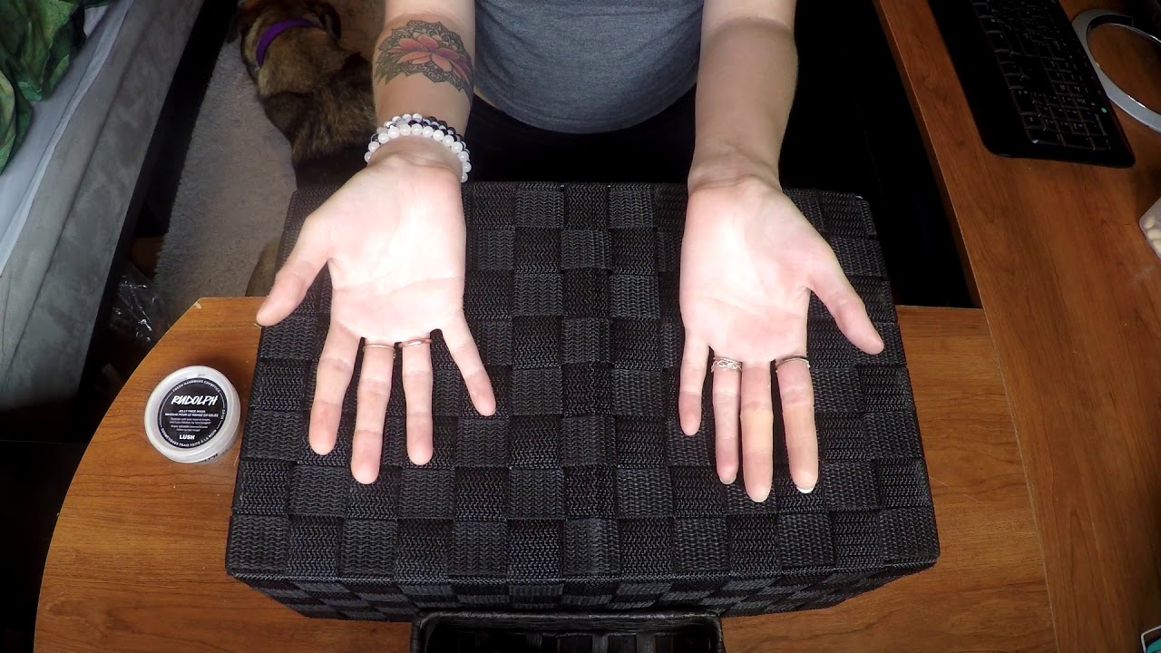 My Amputation Journey: Receiving my Trial Prosthetics