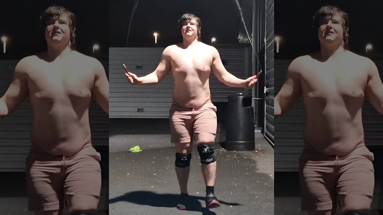 So You Contracted Obesity, What Now?