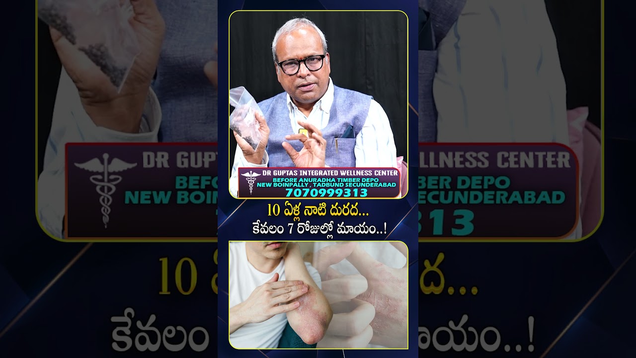 10 ఏళ్ల బాధకు 7 రోజుల్లో ముగింపు..! #drgupta #itching #skinproblems #naturalcare #homeremedies