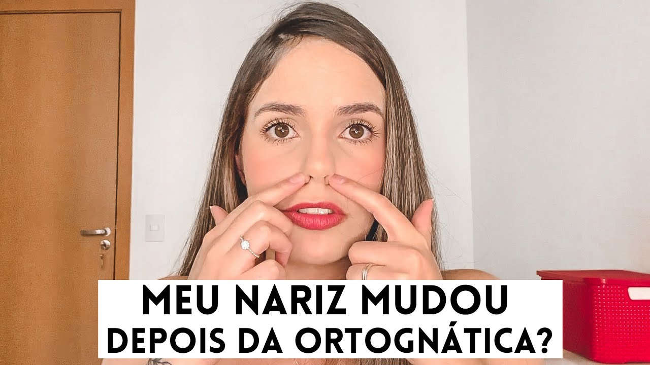Meu nariz mudou? | Cirurgia Ortognática