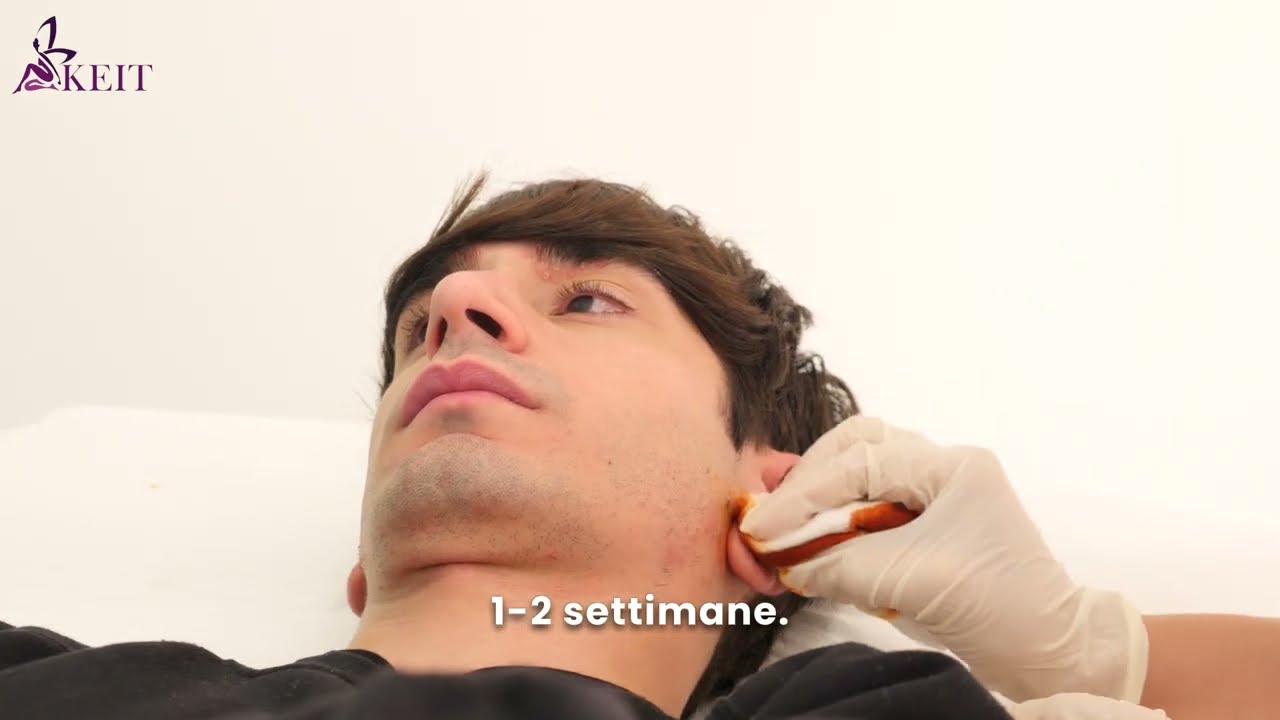 Quanto Costa Davvero L'otoplastica? - Lo spiega il Dottor Skerdi Faria