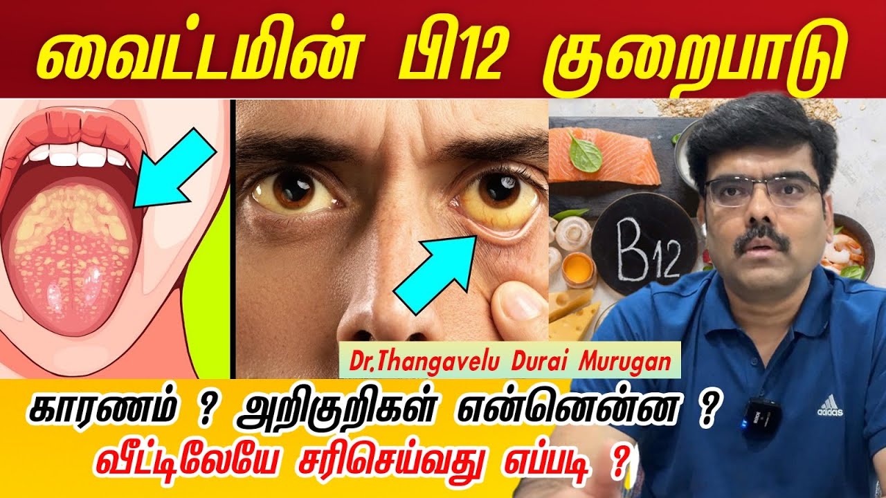 Vitamin B12 Rich Foods  | Vitamin B12 deficiency-வைட்டமின் பி12 குறைபாடு காரணம் அறிகுறிகள் என்னென்ன?