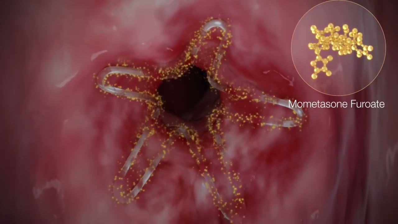 PROPEL Contour Patient Animation