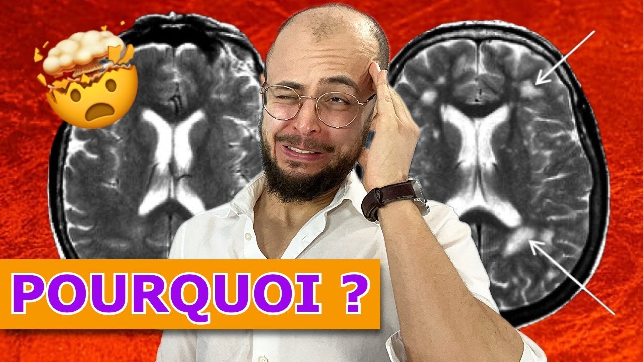 8 Causes de MIGRAINE, Mal de tête (Alimentation, Hormones, Environnement)