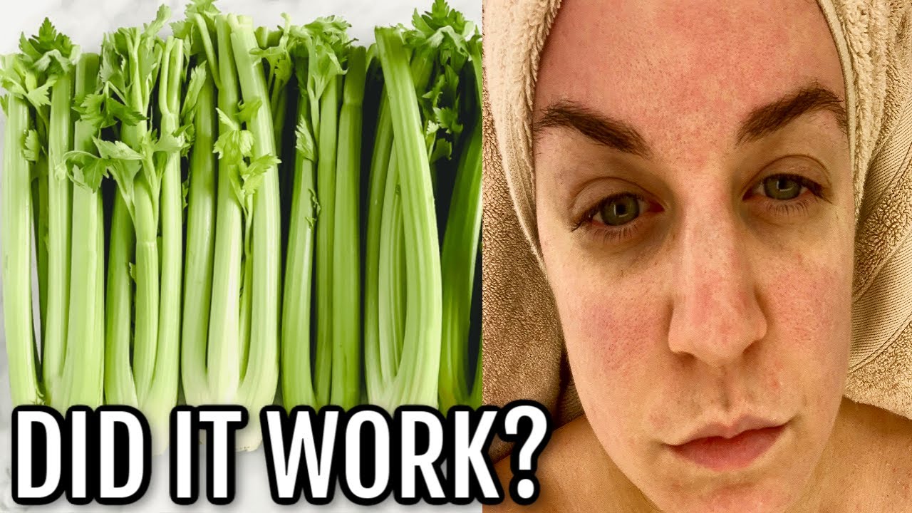 How I CURED My Chronic Illness With Celery Juice