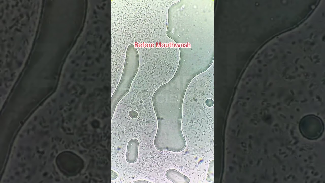 Mouthwash vs. millions of microbes! 🤯 See the microscopic battle! 🦠💦 