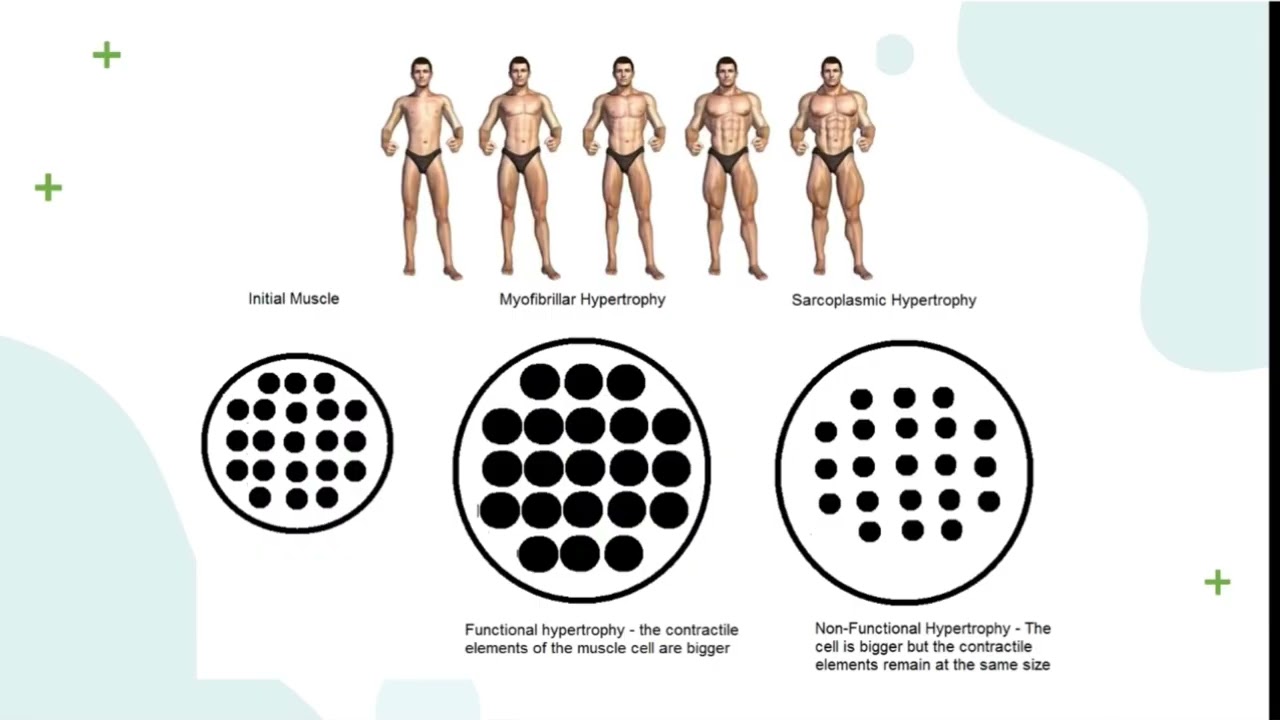 Hipertrofia Vs Hiperplasia