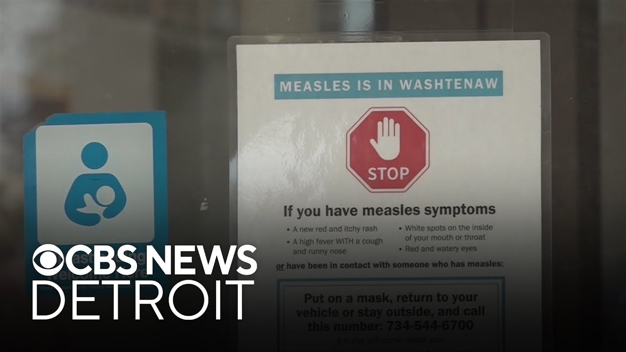 Washtenaw County measles outbreak