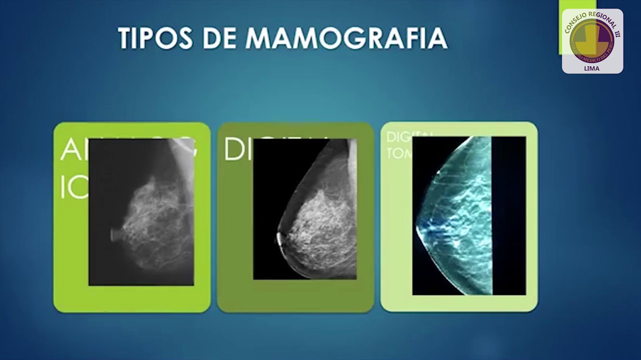 Mamografía y al Nueva Clasificación de BIRADS V Edición - Dr. Hernán Espejo Zarate