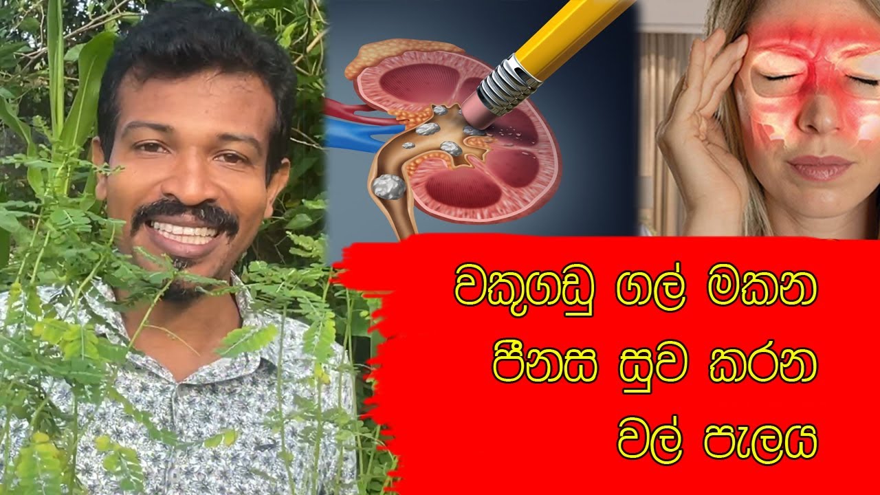 මේ කැද බිව්වොත් වකුගඩු ගල් මකනව විතරක් නෙමෙයි. කෙට්ටු අයව ලස්සන වෙනව
