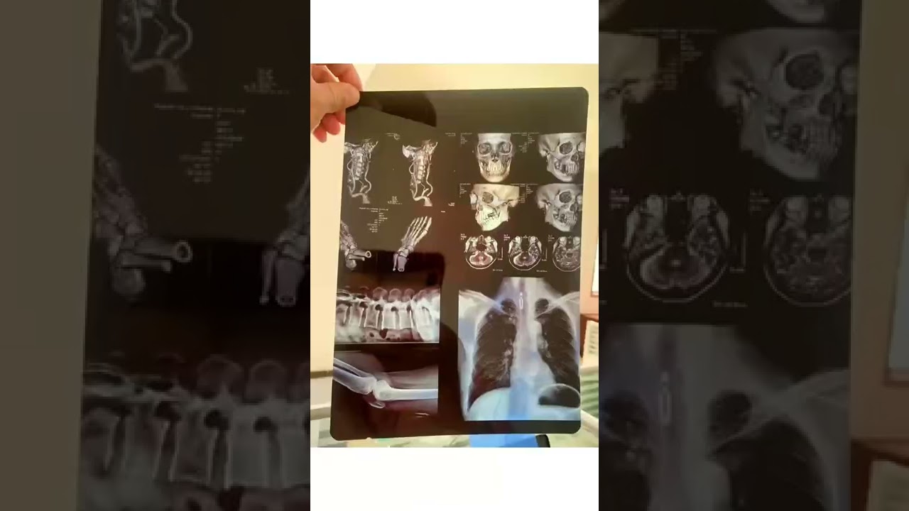 Blue Inkjet & Thermal Medical Film