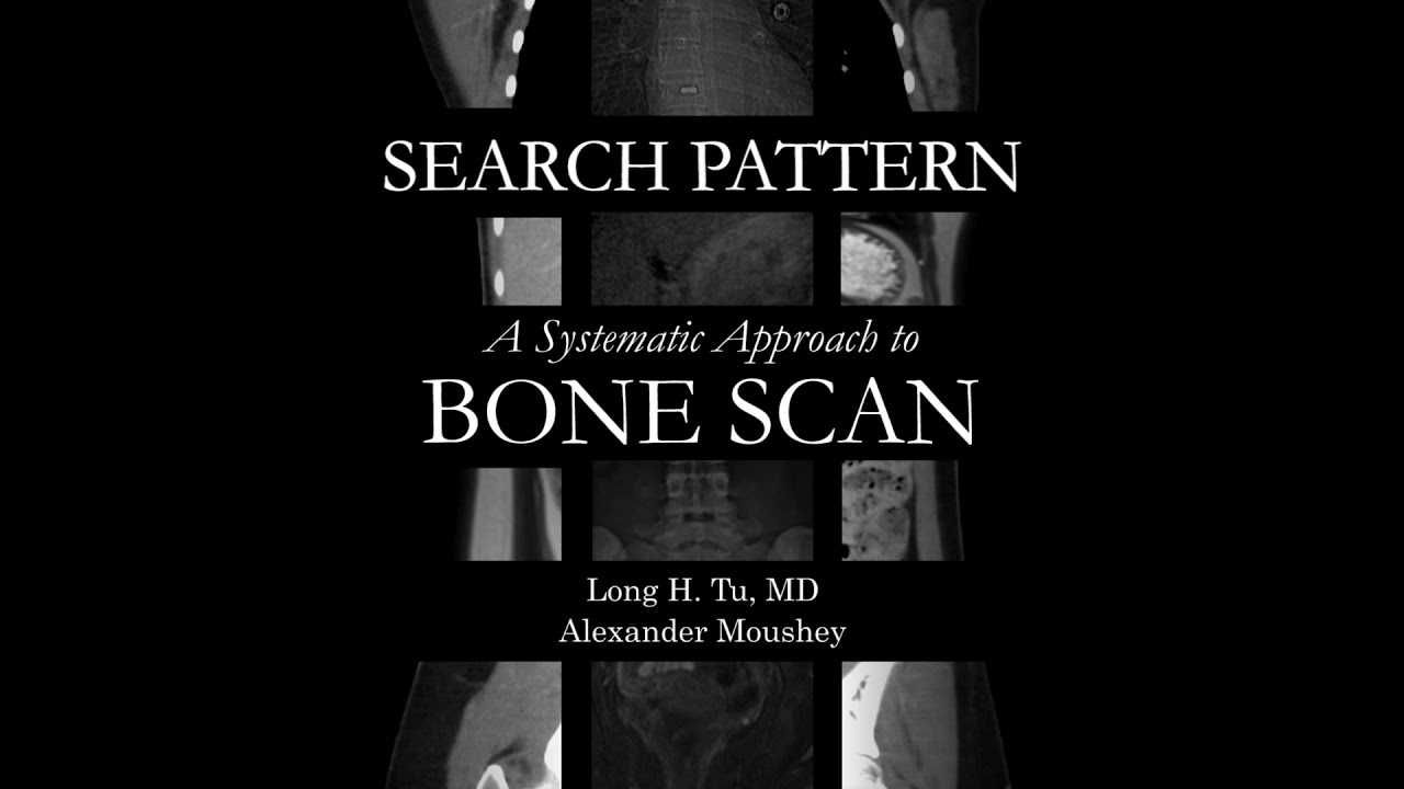 [NM] Bone Scan | Search Pattern