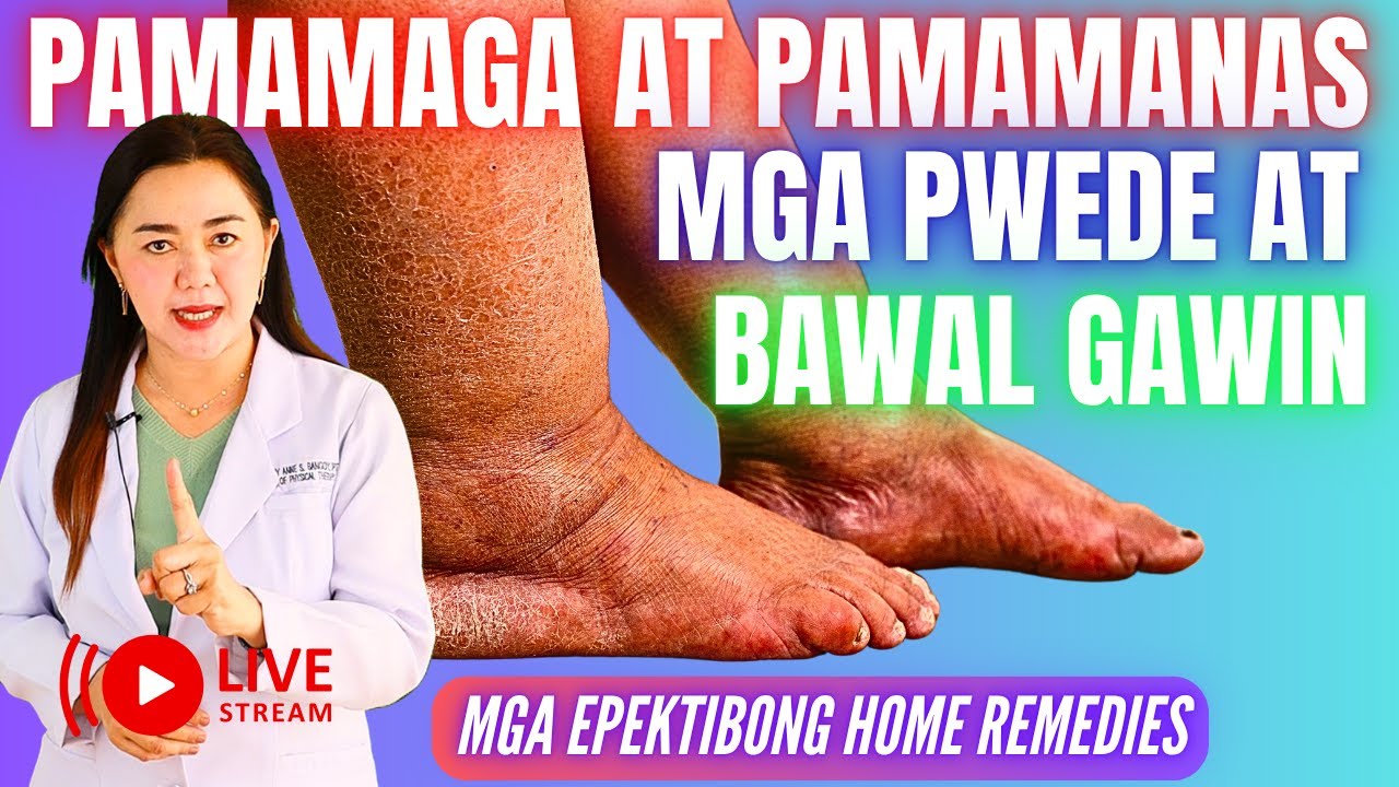 Pamamaga at Pamamanas sa Binti at Paa: Anong Dapat Gawin at Bawal Gawin?