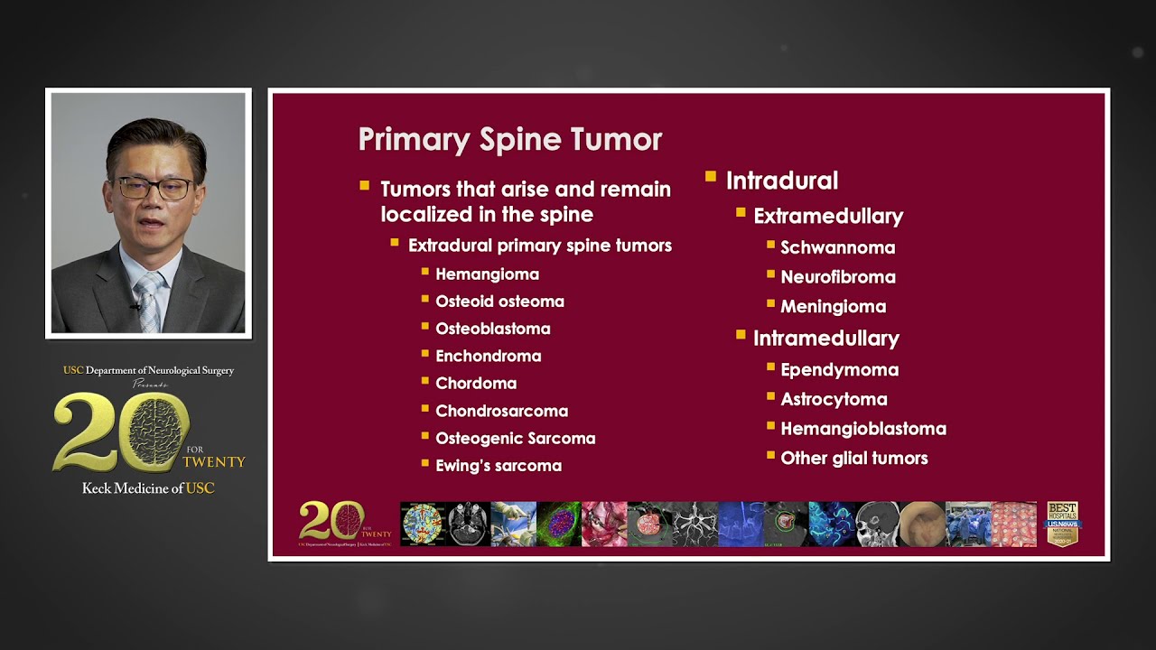 Surgical Management of Complex Spine Tumors