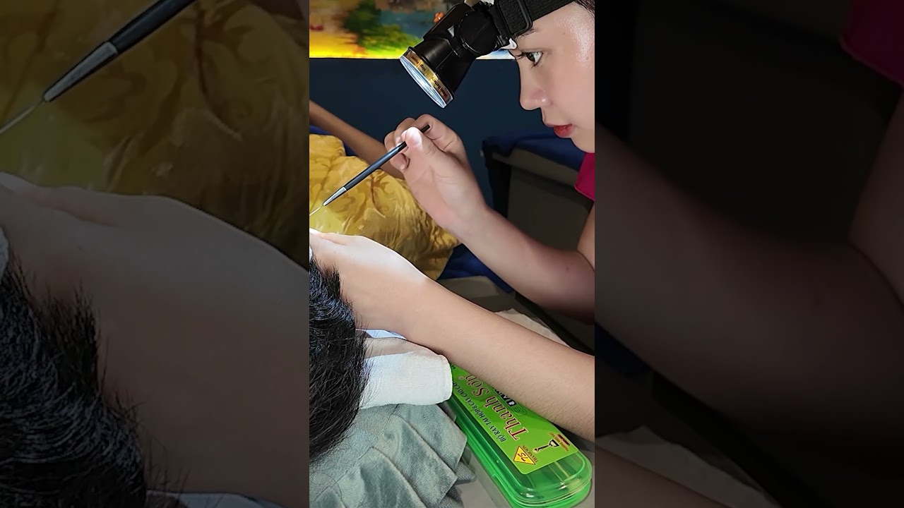 [Short ASMR] Close-Up Ear Cleaning + 귀청소 클로즈업 / 耳のアップケア feat. Yue Yuan Spa