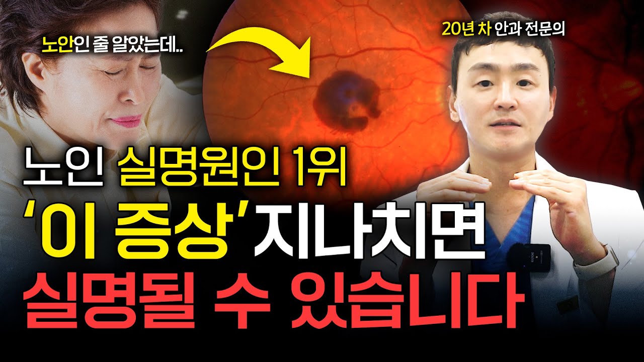 '노인 실명' 1위 황반변성, 이것만 알아도 시력 지킬 수 있습니다