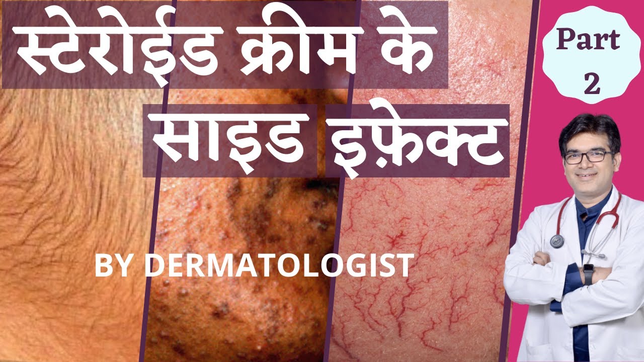 Steroid Creams Side effects, Steroid Damaged Face | Fairness cream, betnovate, panderm side effects
