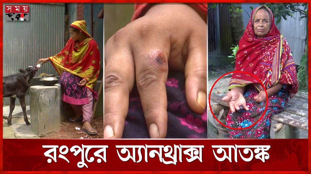 অসুস্থ পশুর সংস্পর্শে গিয়ে অজানা রোগে আক্রান্ত ২০০ জন | Unknown Disease | Pirgacha News | Somoy TV