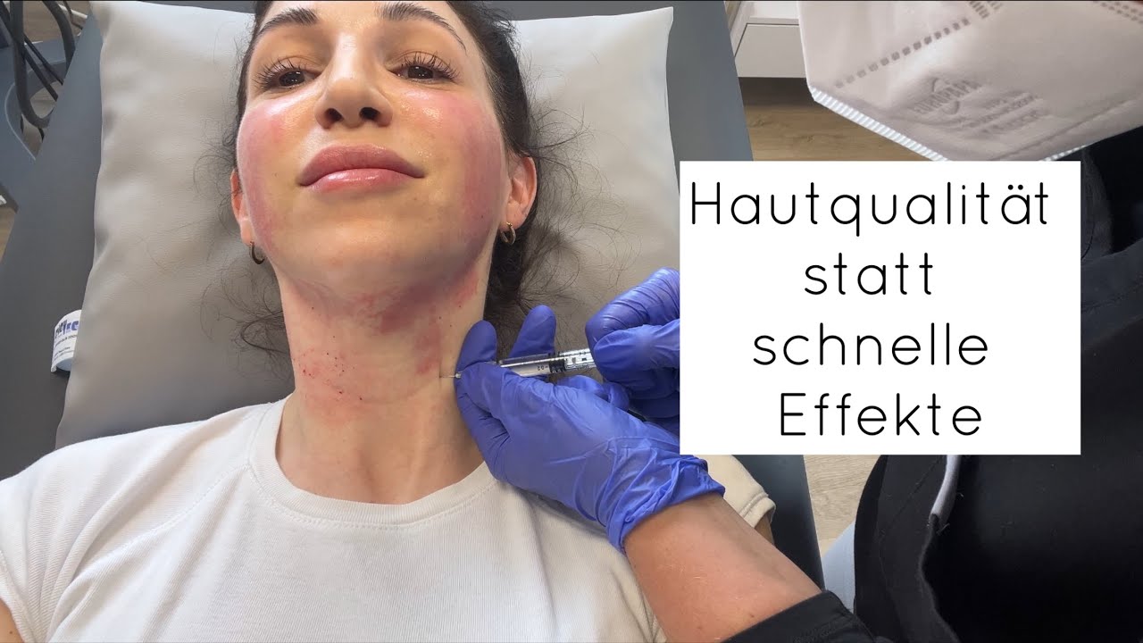 Hals & Gesicht straffen ohne OP | Laser, HIFU & Polynukleotide – meine ehrliche Erfahrung