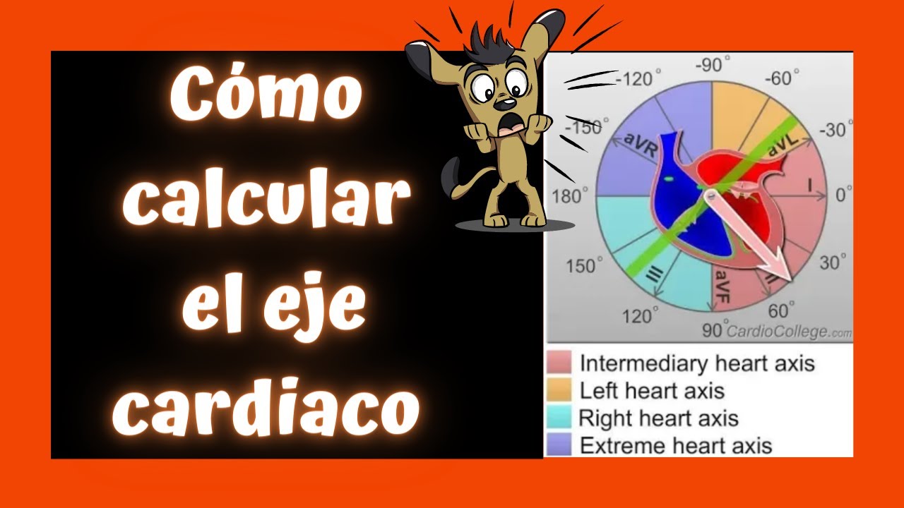 Cómo calcular el EJE CARDÍACO ↘️ en un ELECTROCARDIOGRAMA