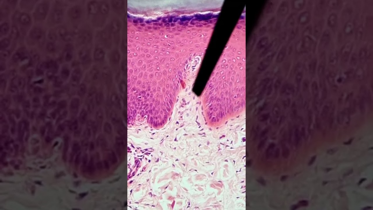 &iexcl;La CAPA PAPILAR!La Dermis  #histolog&iacute;a #dermis  #dermispapilar #ingenieriadetejidosco