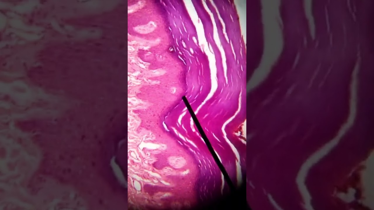 ¡Me ericé! / capas de la piel / epidermis / #histologia #medicina #piel