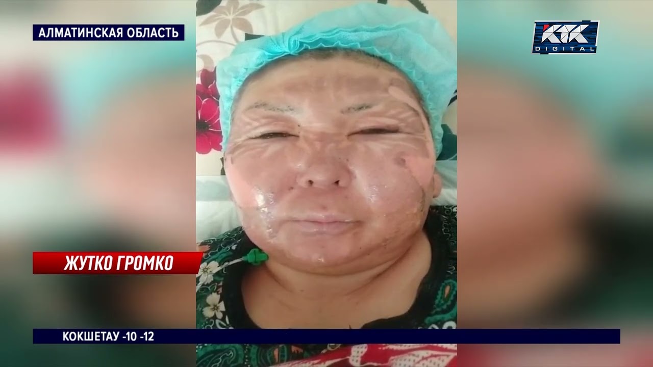 Взрыв природного газа произошел в частном доме села Байсерке, пострадали два квартиранта