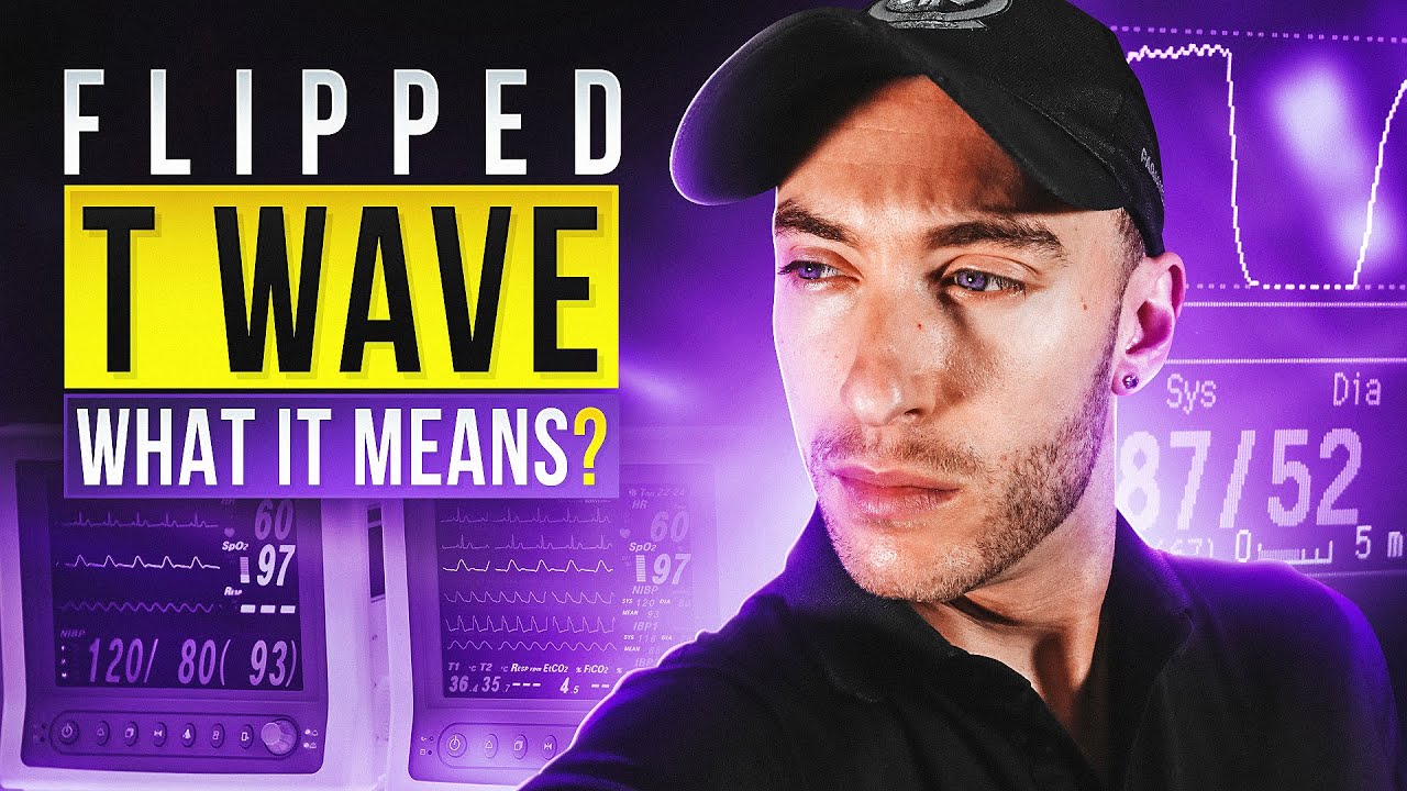 12 Lead EKG Review for Paramedic School | What is an Inverted T Wave Mean?