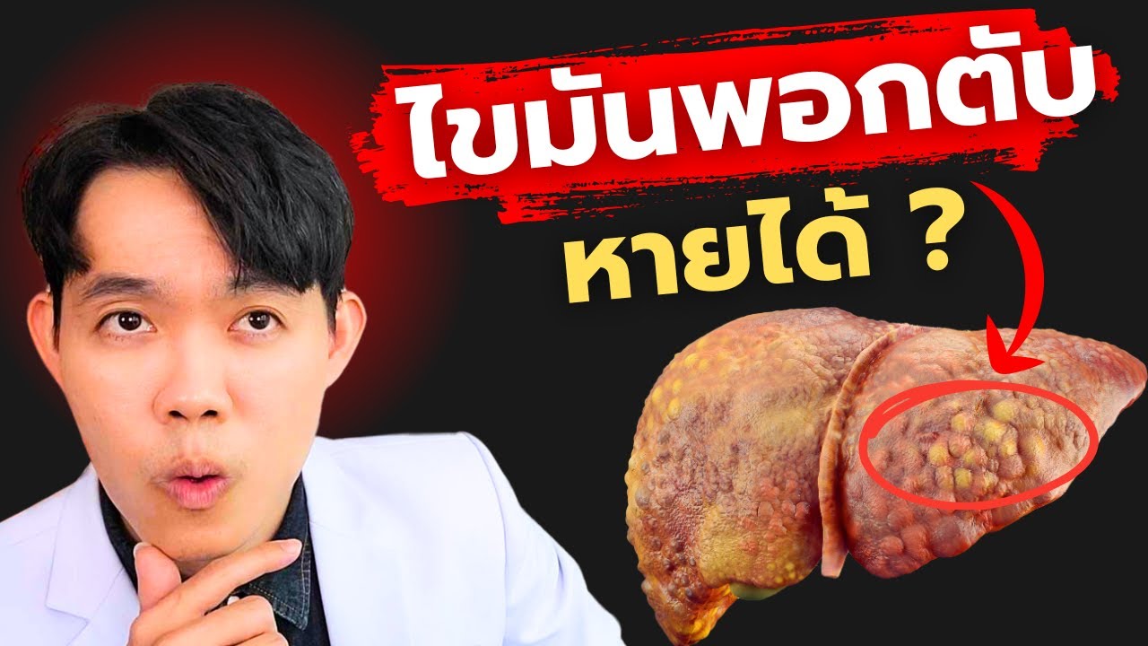 ไขมันพอกตับ หายได้ใน 3 เดือน แค่ทำตามนี้ | หมอแบงค์ food doctor