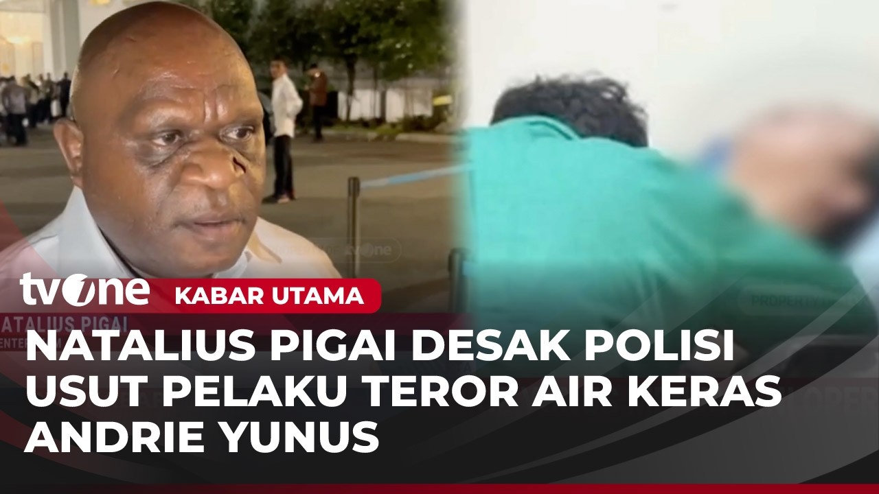 Disiram Air Keras, Andrie Yunus Langsung Jalani Operasi Mata dan Alami Luka Bakar | Kabar Utama