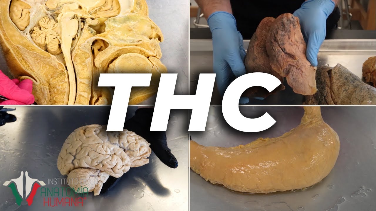 La ANATOM&Iacute;A del THC