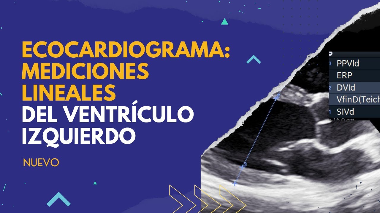 ✅ECOCARDIOGRAMA:MEDICIONES lineales del ventriculo izquierdo. ⚠️NO TE PIERDAS ESTO
