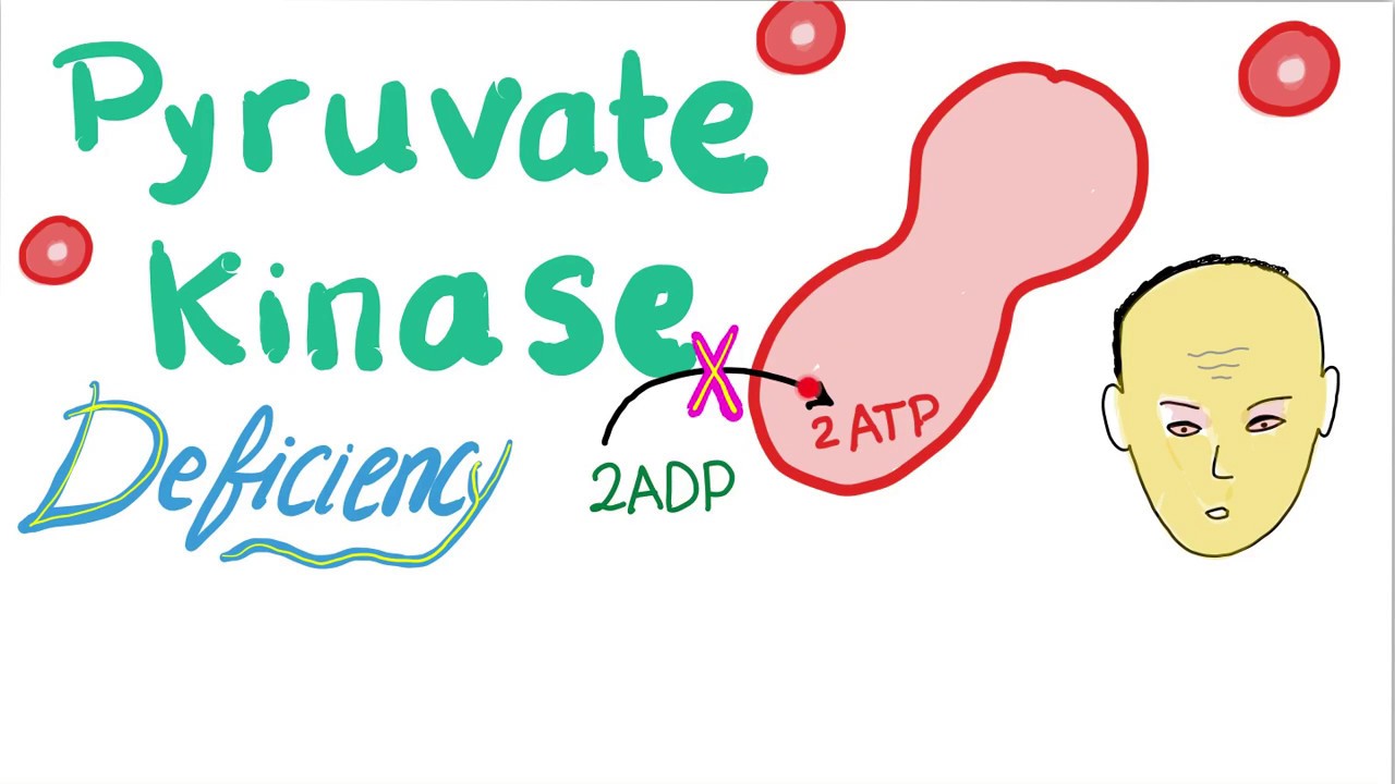 Pyruvate Kinase Deficiency | Hemolytic Anemia