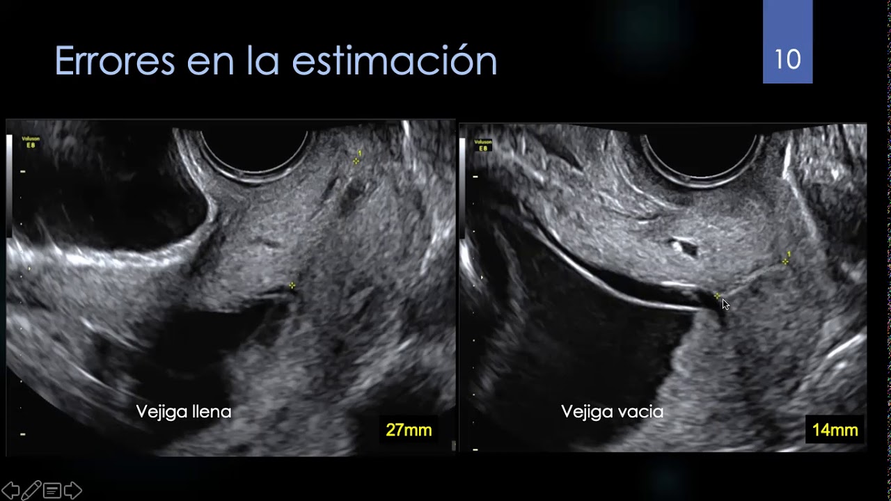 Cérvix, Placenta y Líquido amniótico.
