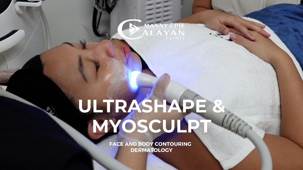 Ultrashape and Myosculpt - Slimming and Firming Treatment | Manny and Pie Calayan Clinic (2024)