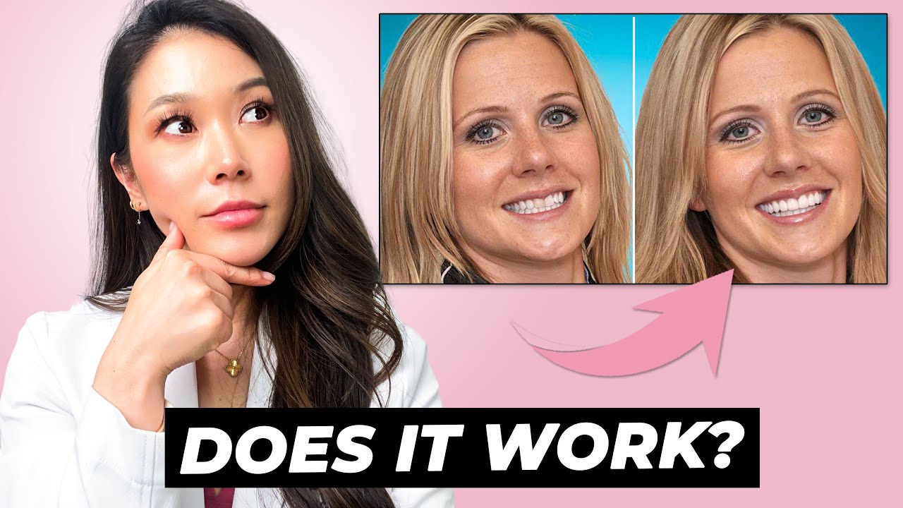 Can veneers give you a wider smile?