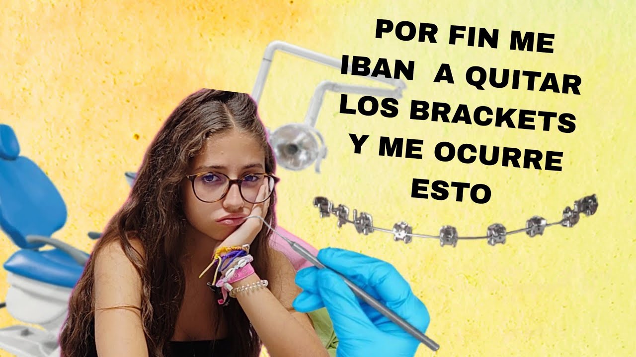 😮‍💨 Por fin me iban a quitar los brackets y me ocurre esto