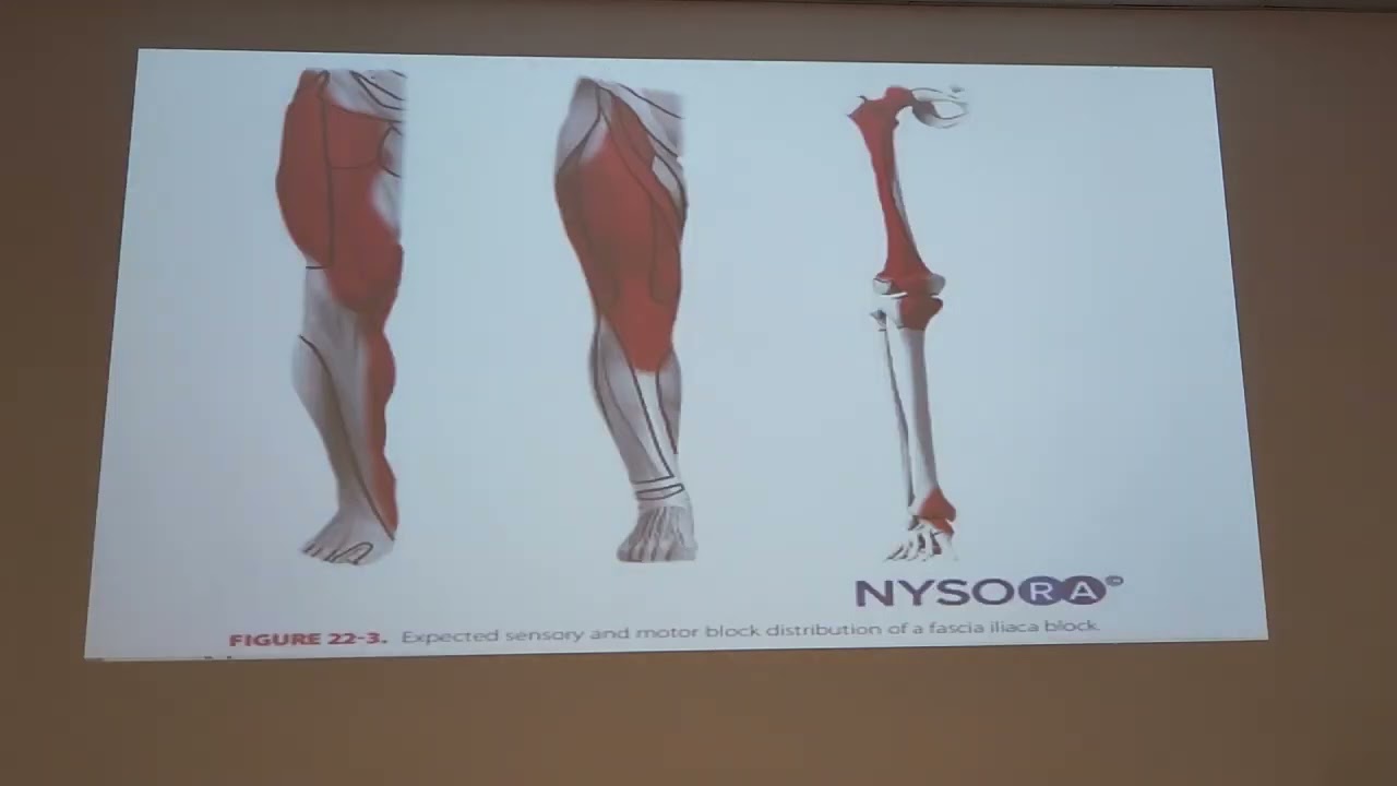 12.04.2024 Dr. Muhammed Köse - Alt Ekstremite Blokları