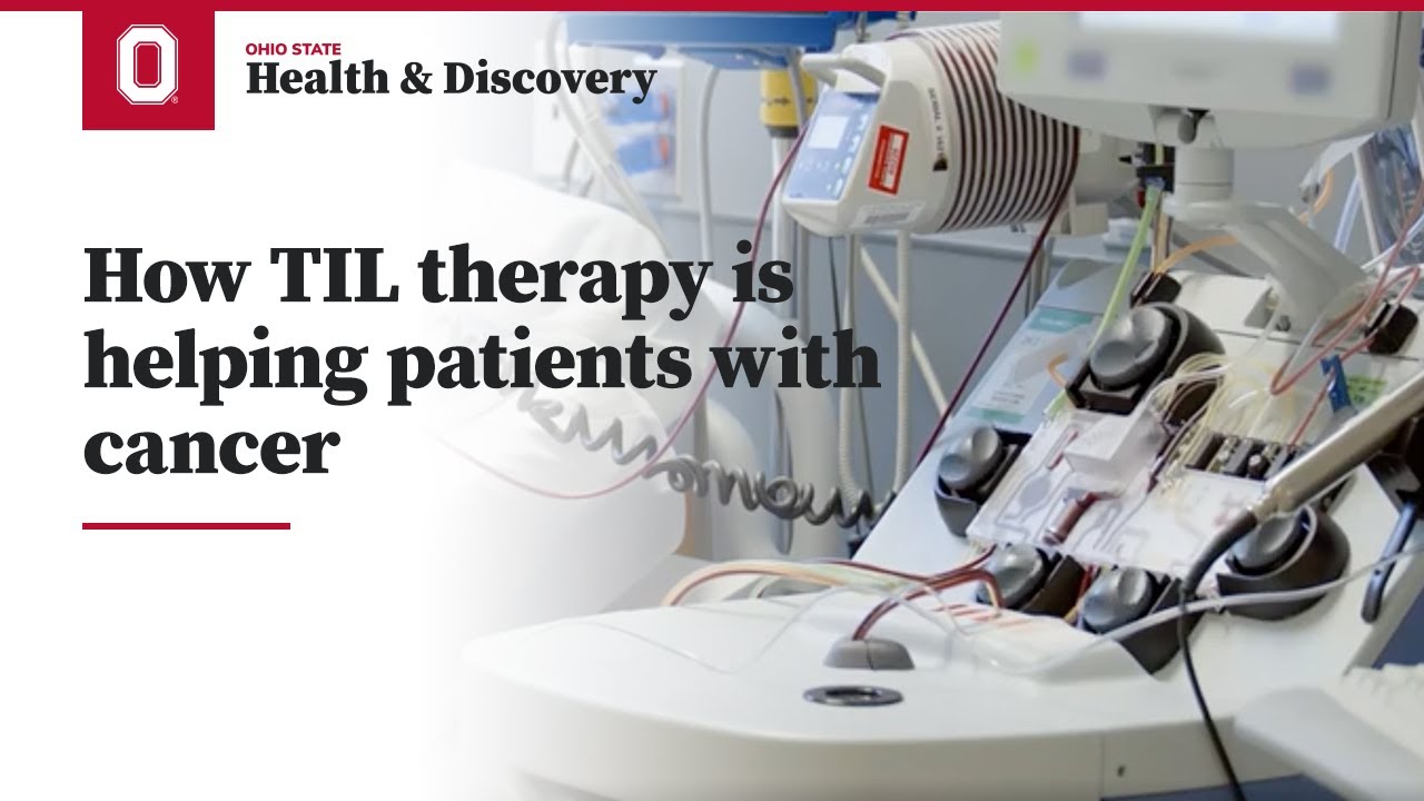How TIL therapy is helping patients with cancer | Ohio State Medical Center