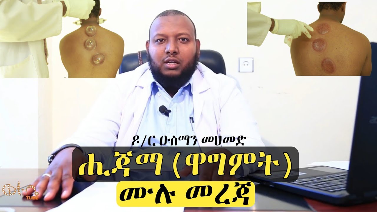 [ሙሉ መረጃ] ስለ ሒጃማ ወይም ዋግምት በዶ/ር ዑስማን መሀመድ | Hijama | Dr Ousman Muhammed