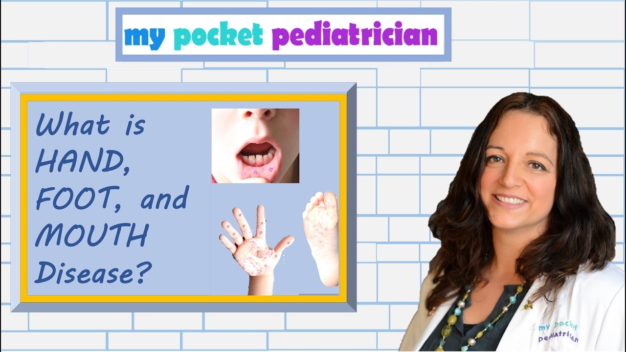 Hand, Foot, and Mouth Disease