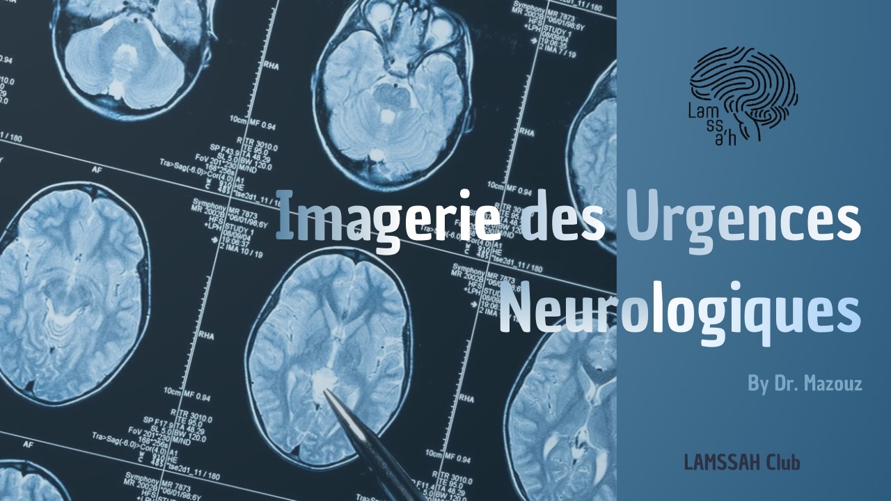 Séance 1 : Les Clés d’Interprétation en Imagerie des Urgences Neurologiques – Dr. Mazouz
