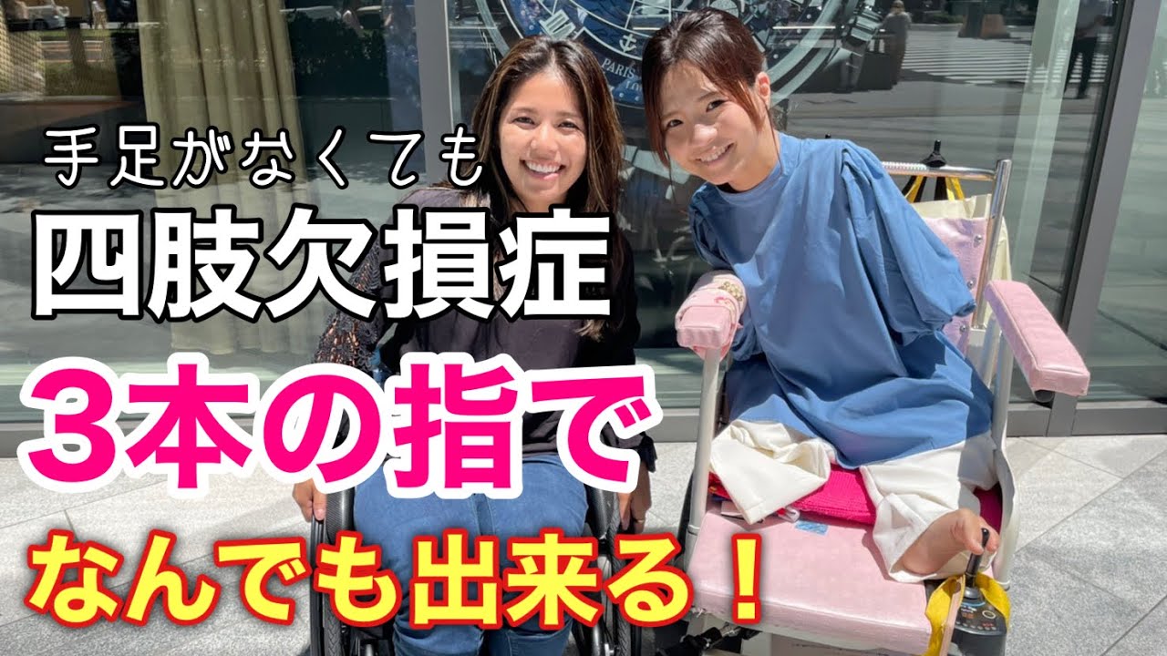 【先天性四肢欠損症】恋愛・結婚・出産。両手両足がない中でどう工夫してるのか！気になること全部聞いてみた！