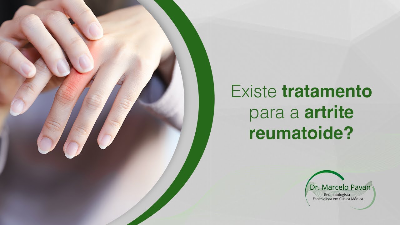 Existe tratamento para a artrite reumatoide?