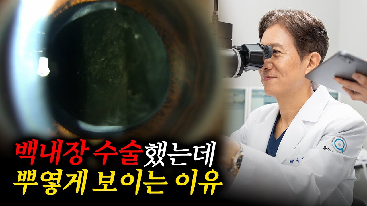 백내장 수술했는데 시야가 다시 흐려진 이유 😧 백내장 재발인가요?