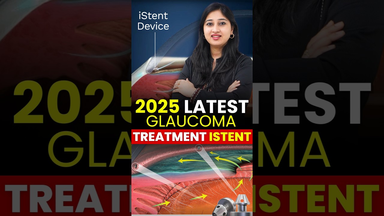 2025 Latest Glaucoma Treatment: All About iStent Surgery
