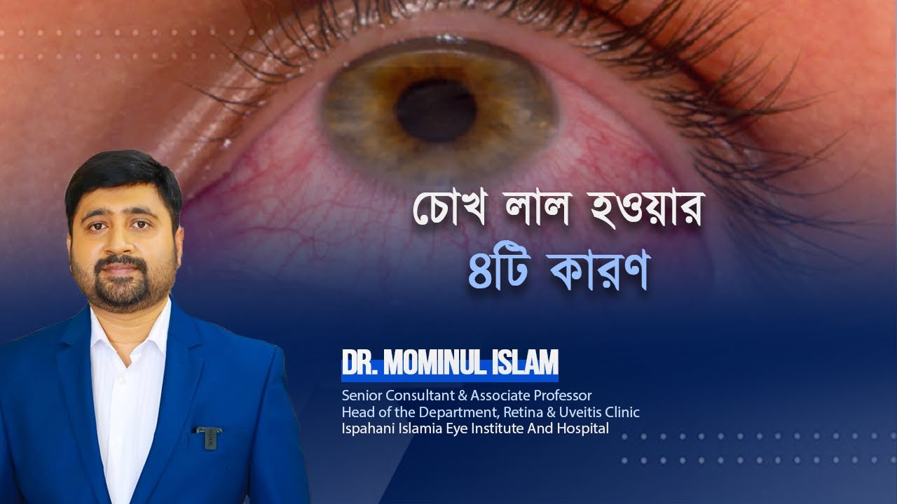 চোখ লাল হওয়ার ৪টি কারণ