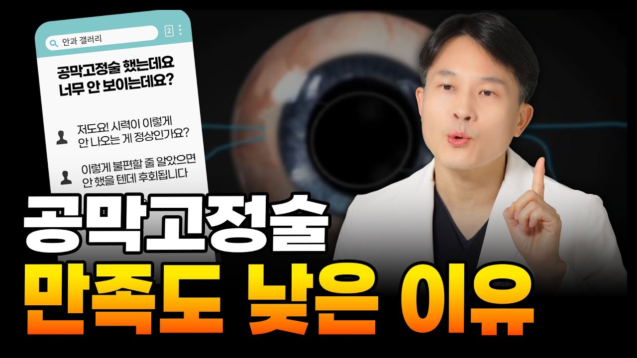 공막고정술 결과는 3가지가 좌우합니다 | 렌즈 선택부터 난시교정까지